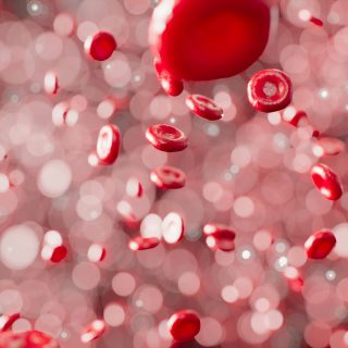 Stem cell transplantation for MPS-IH