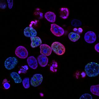 Daratumumab with bortezomib, lenalidomide and dexamethasone for untreated multiple myeloma